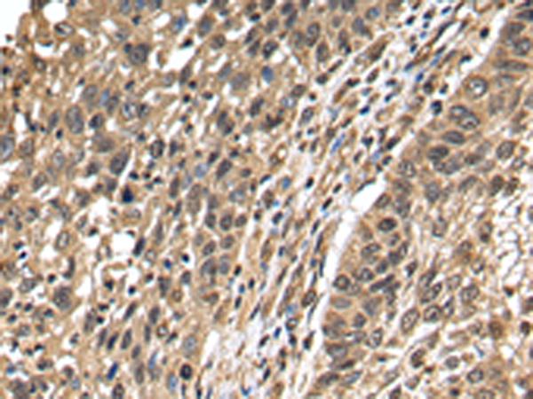 Rabbit Polyclonal Antibody to TFDP2