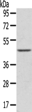 Rabbit Polyclonal Antibody to LEFTY2