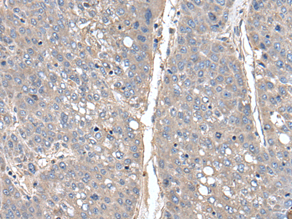 Rabbit Polyclonal Antibody to THAP10