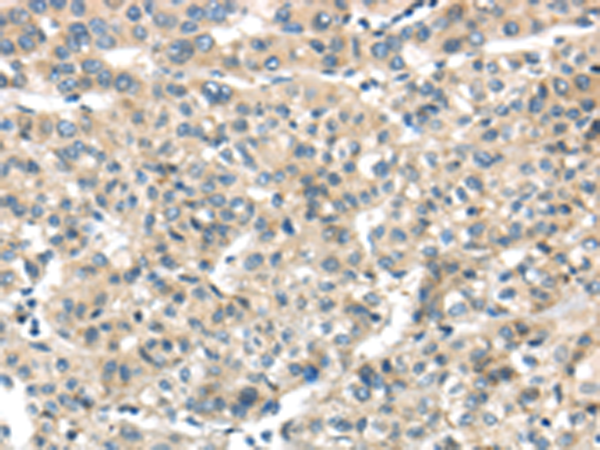 Rabbit Polyclonal Antibody to THAP2