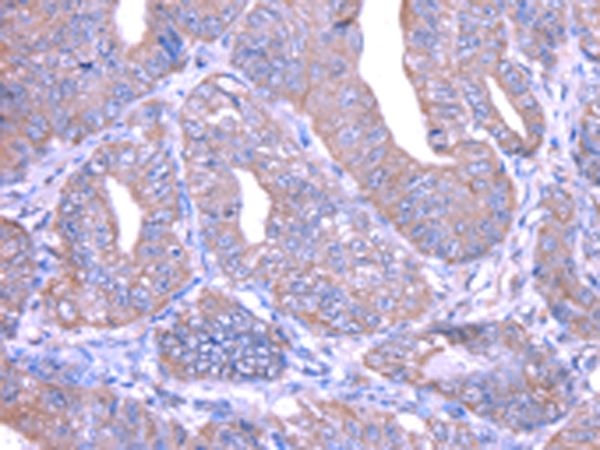 Rabbit Polyclonal Antibody to THAP6
