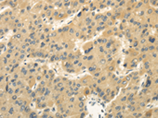 Rabbit Polyclonal Antibody to MED16