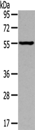 Rabbit Polyclonal Antibody to THRA