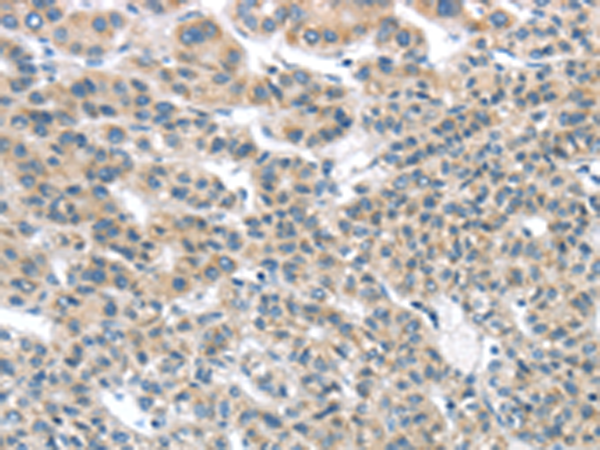 Rabbit Polyclonal Antibody to THSD1