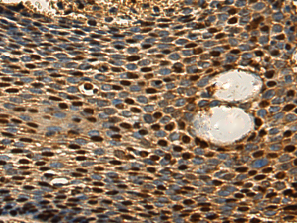 Rabbit Polyclonal Antibody to PTMA
