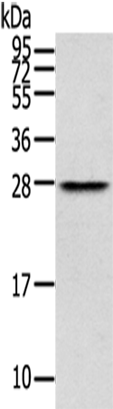 Rabbit Polyclonal Antibody to THYN1