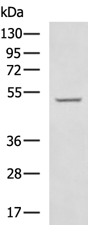 Rabbit Polyclonal Antibody to SERPINA7