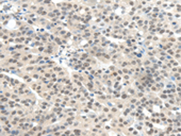 Rabbit Polyclonal Antibody to TRIM11