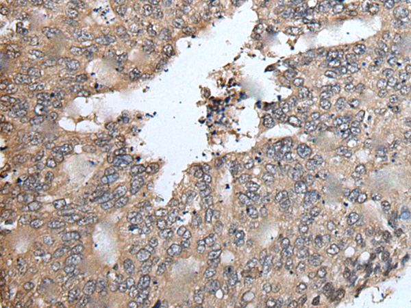 Rabbit Polyclonal Antibody to TRIM23