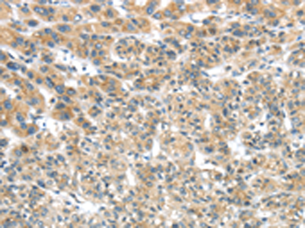 Rabbit Polyclonal Antibody to TRIM16