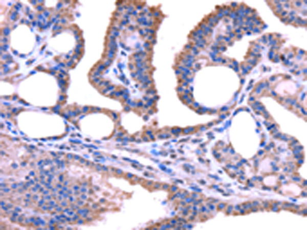 Rabbit Polyclonal Antibody to TRIM49