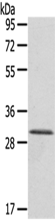 Rabbit Polyclonal Antibody to HTATIP2