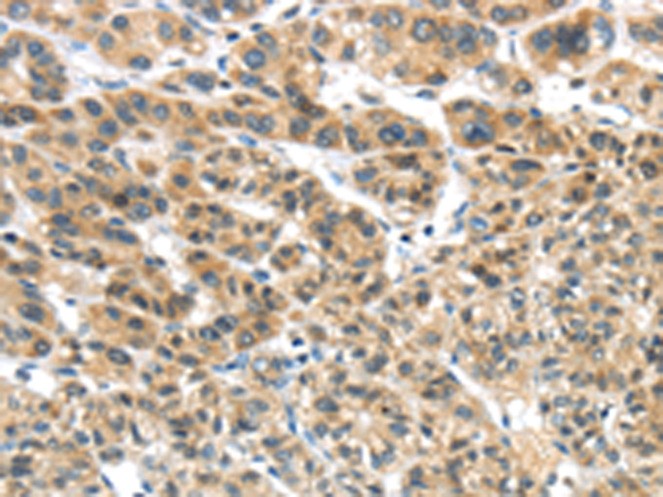 Rabbit Polyclonal Antibody to TKTL1
