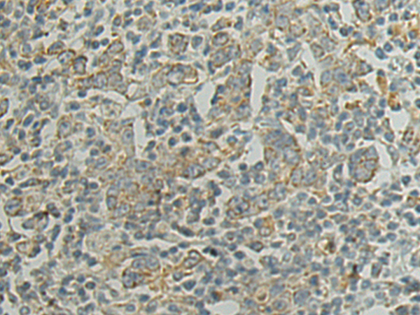 Rabbit Polyclonal Antibody to TLK2