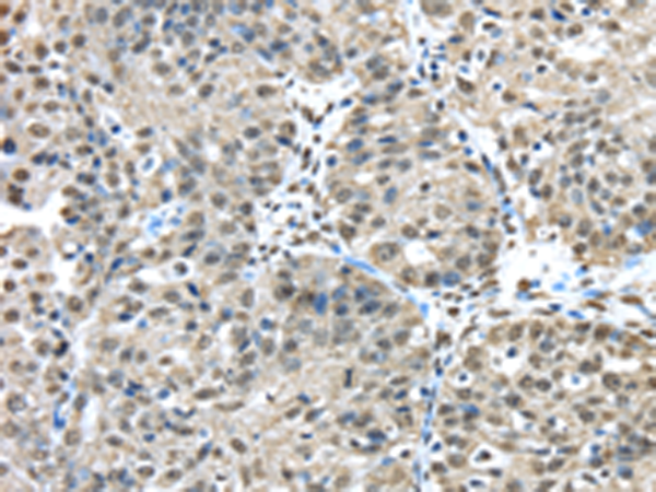 Rabbit Polyclonal Antibody to FUS