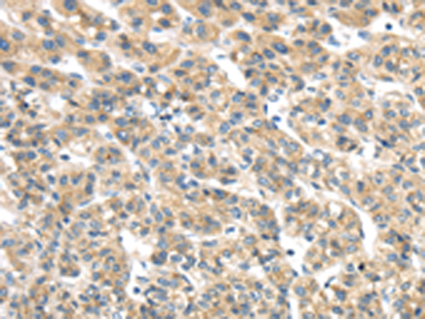 Rabbit Polyclonal Antibody to TMED2
