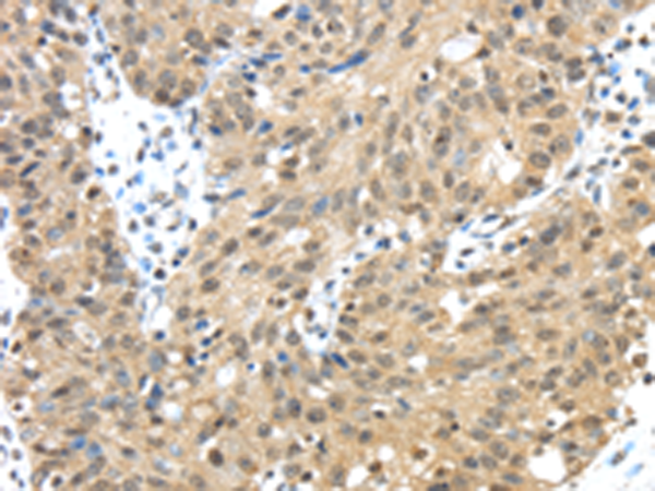 Rabbit Polyclonal Antibody to TMED3