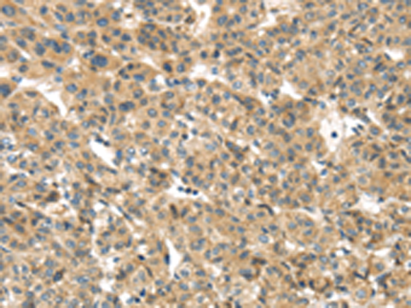Rabbit Polyclonal Antibody to TMEM161A