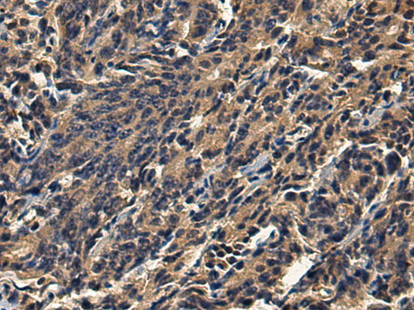Rabbit Polyclonal Antibody to TMPRSS5