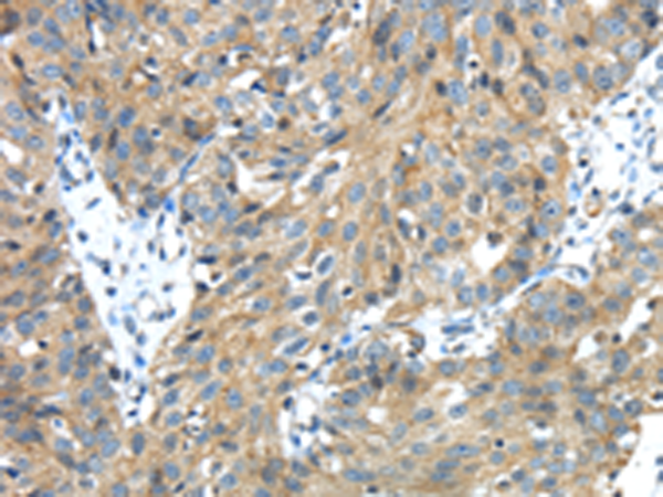 Rabbit Polyclonal Antibody to TMPRSS13