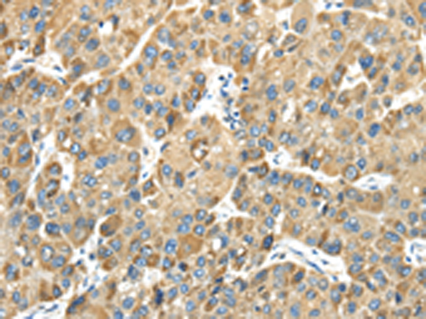 Rabbit Polyclonal Antibody to TMPRSS11E