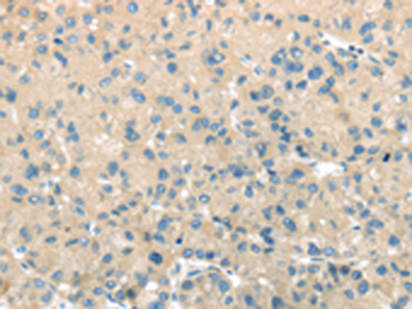 Rabbit Polyclonal Antibody to TMPRSS11A