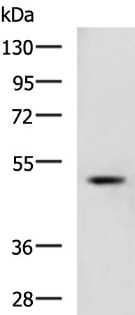 Rabbit Polyclonal Antibody to TMPRSS11D