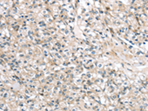 Rabbit Polyclonal Antibody to TMPRSS11B
