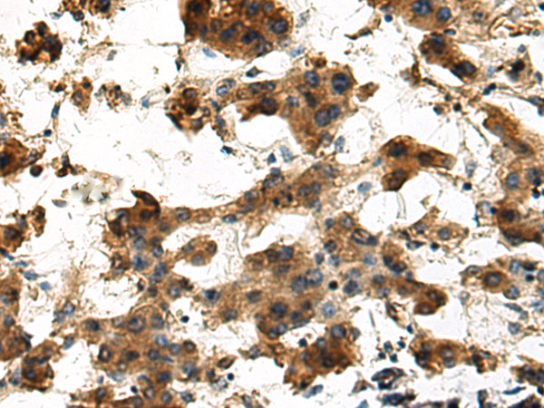 Rabbit Polyclonal Antibody to TNFAIP3