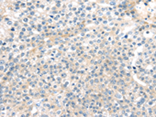 Rabbit Polyclonal Antibody to TNFAIP8