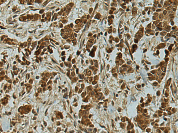 Rabbit Polyclonal Antibody to TMEFF1