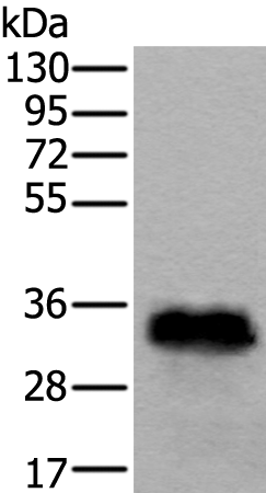 Rabbit Polyclonal Antibody to TPSB2