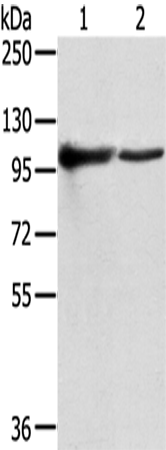 Rabbit Polyclonal Antibody to TPX2