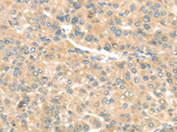 Rabbit Polyclonal Antibody to TRAK1