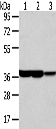 Rabbit Polyclonal Antibody to TALDO1