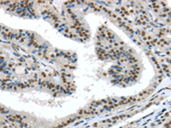 Rabbit Polyclonal Antibody to TKT
