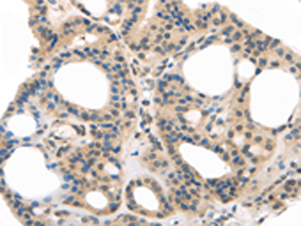 Rabbit Polyclonal Antibody to MED28