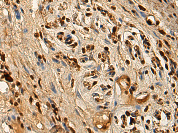 Rabbit Polyclonal Antibody to MED4