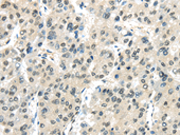 Rabbit Polyclonal Antibody to MED18