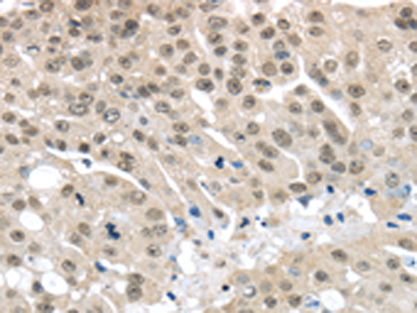 Rabbit Polyclonal Antibody to MED15