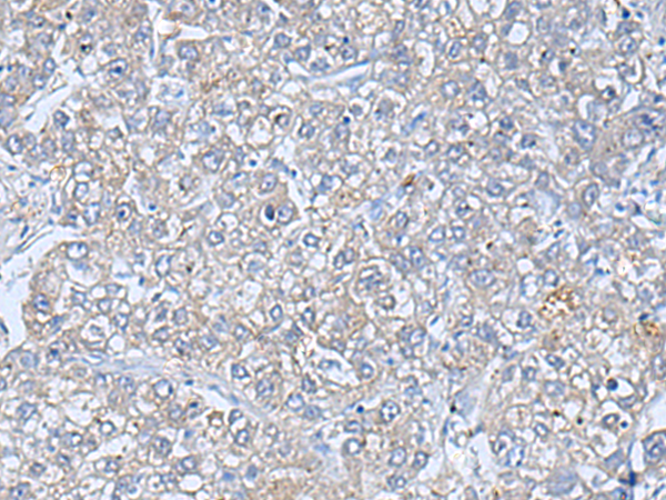 Rabbit Polyclonal Antibody to TREM1