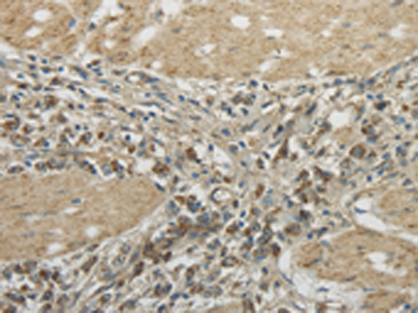 Rabbit Polyclonal Antibody to TRIB2