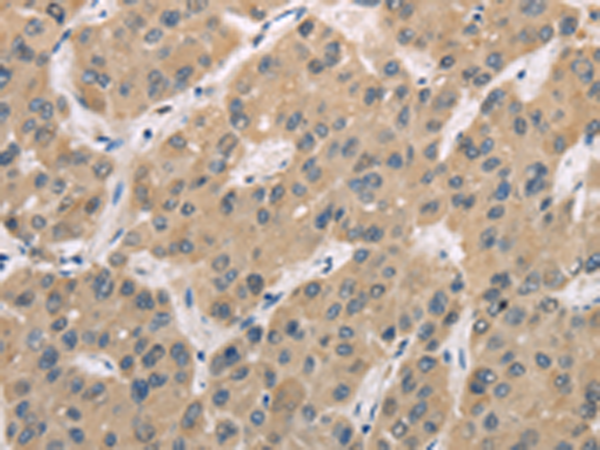 Rabbit Polyclonal Antibody to TRIB3