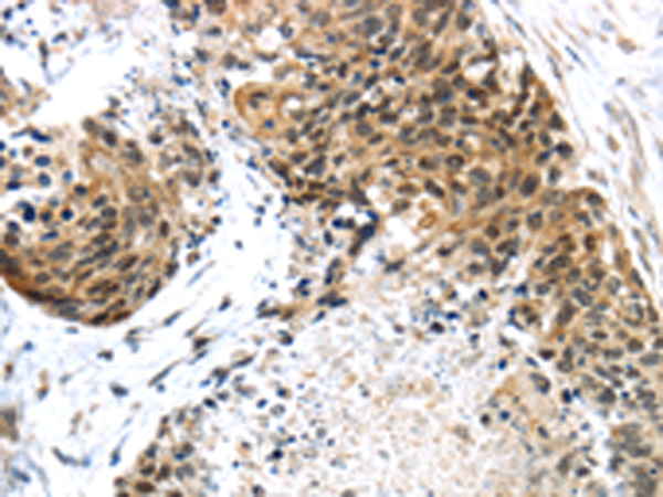 Rabbit Polyclonal Antibody to TRIM74