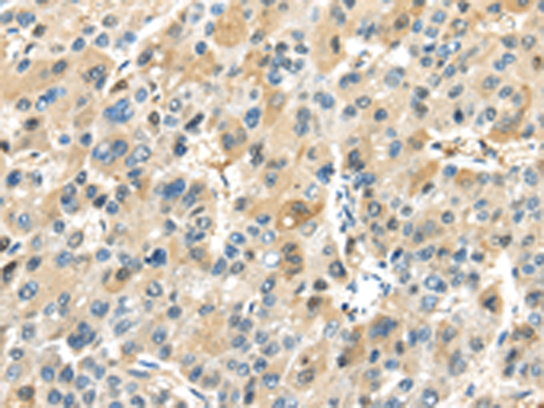 Rabbit Polyclonal Antibody to TRAIP