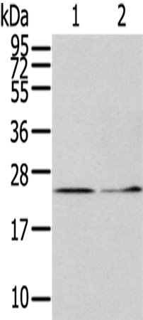 Rabbit Polyclonal Antibody to ITPA