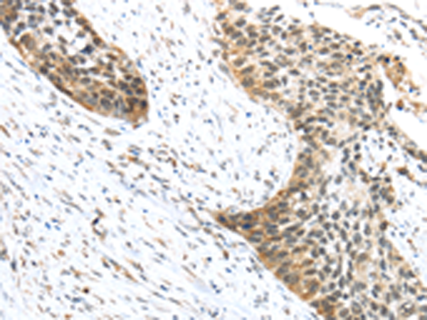 Rabbit Polyclonal Antibody to TRIP6