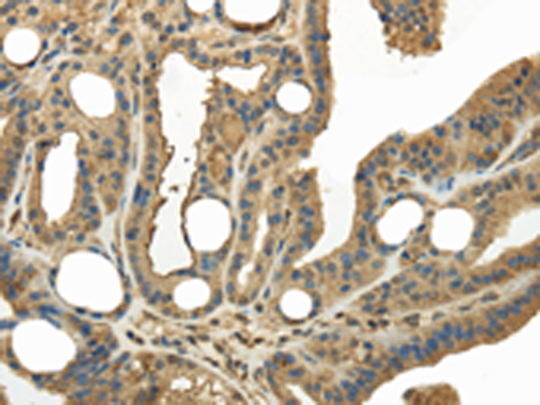 Rabbit Polyclonal Antibody to KEAP1