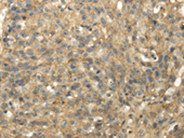 Rabbit Polyclonal Antibody to TACSTD2