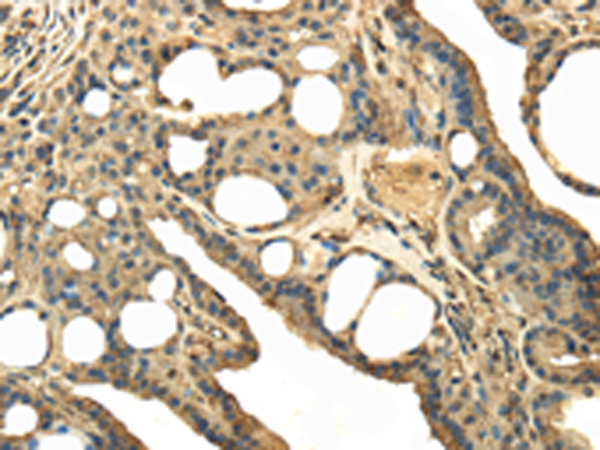 Rabbit Polyclonal Antibody to TRPC4AP